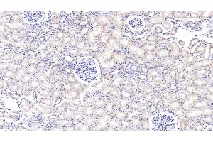 Detection of PIGR in Bovine Kidney Tissue using Polyclonal Antibody to Polymeric Immunoglobulin Receptor (PIGR) (PIGR antibody  (AA 461-560))