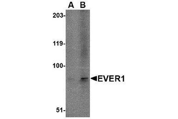 TMC6 antibody  (N-Term)