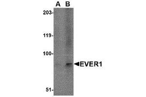Western blot analysis of EVER1 in A-20 cell lysate with AP30321PU-N EVER1 antibody at (A) 1 and (B) 2 μg/ml.