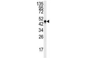 Western blot analysis of Neuron Specific Enolase antibody and Y79 lysate. (ENO2/NSE antibody  (AA 213-239))