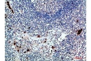 Immunohistochemical analysis of paraffin-embedded human-lymph, antibody was diluted at 1:200 (ZAP7 (AA 391-440) antibody)