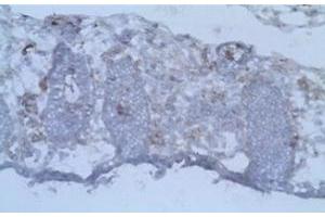 Immunohistochemistry (IHC) image for anti-CD40 Ligand (CD40LG) antibody (ABIN1105904) (CD40 Ligand antibody)