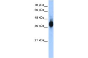 Western Blotting (WB) image for anti-LIM Domain Binding 1 (LDB1) antibody (ABIN2461587) (LIM Domain Binding 1 Protein antibody)