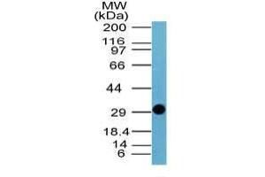 Image no. 1 for anti-Influenza Non Structural 1 antibody (Influenza A Virus H1N1) (AA 24-39) (ABIN960231) (Influenza A NS1 antibody  (AA 24-39))