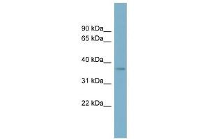 SPAG4L antibody used at 1 ug/ml to detect target protein. (SUN5 antibody  (N-Term))