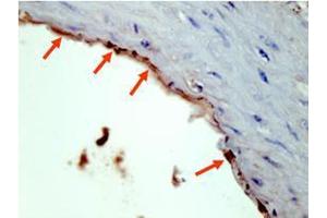 Affinity Purified anti-HA epitope tag polyclonal antibody detects HA tagged recombinant proteins by IHC on formalin fixed paraffin embedded tissue. (HA-Tag antibody)