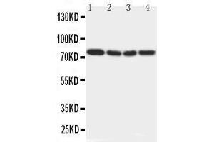 Anti-IRAK antibody, Western blotting Lane 1: Rat Liver Tissue Lysate Lane 2: Human Placenta Tissue Lysate Lane 3: MCF-7 Cell Lysate Lane 4: PANC Cell Lysate