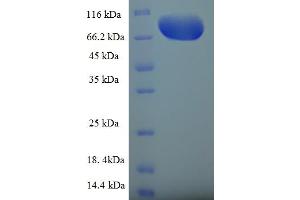SDS-PAGE (SDS) image for Guanine Nucleotide Binding Protein-Like 3 (Nucleolar)-Like (GNL3L) (AA 1-582), (full length) protein (His-SUMO Tag) (ABIN5711791)
