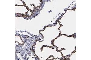 Immunohistochemical staining of human lung with MAGEB10 polyclonal antibody  shows strong cytoplasmic and membranous positivity in alveolar cells at 1:500-1:1000 dilution. (MAGEB10 antibody)