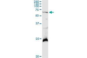 GALNT4 MaxPab rabbit polyclonal antibody. (GALNT4 antibody  (AA 1-578))