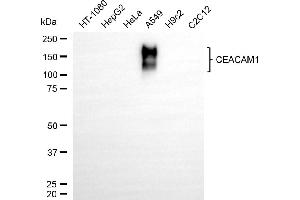 Western blotting analysis using CEACAM1 antibody (ABIN7797874).