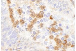 Immunohistochemistry (IHC) image for anti-Glucose-6-Phosphate Dehydrogenase (G6PD) (AA 50-100) antibody (ABIN7448574)