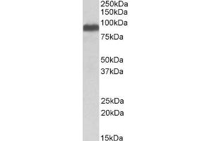 ITCH antibody  (Internal Region)