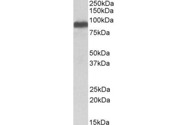 ITCH antibody  (Internal Region)