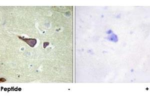 Immunohistochemical analysis of paraffin-embedded human brain tissue using IGF2R polyclonal antibody . (IGF2R antibody)