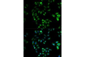 Immunofluorescence (IF) image for anti-Hydroxysteroid (17-Beta) Dehydrogenase 2 (HSD17B2) antibody (ABIN1873085)