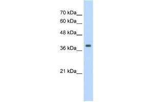 WB Suggested Anti-TPM1 Antibody Titration:  1. (Tropomyosin antibody  (N-Term))