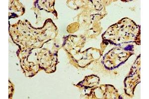 Immunohistochemistry of paraffin-embedded human placenta tissue using ABIN7159637 at dilution of 1:100 (TET2 antibody  (AA 1833-2002))