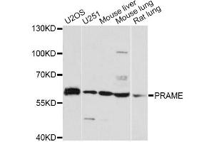 Western blot analysis of extracts of various cell lines, using PRAME antibody. (PRAME antibody)