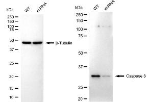 Western blotting analysis using caspase 6 antibody (ABIN7797900). (Recombinant Caspase 6 antibody)