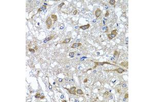 Immunohistochemistry of paraffin-embedded rat brain using OSGEPL1 antibody at dilution of 1:100 (x40 lens). (OSGEPL1 antibody)