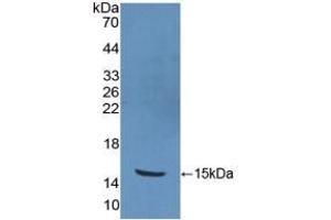 Detection of Recombinant PKIb, Human using Polyclonal Antibody to Protein Kinase Inhibitor Beta (PKIb) (PKIB antibody  (AA 8-76))