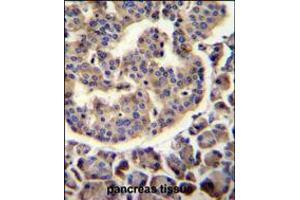 TRIM72 Antibody immunohistochemistry analysis in formalin fixed and paraffin embedded human pancreas tissue followed by peroxidase conjugation of the secondary antibody and DAB staining. (TRIM72 antibody  (C-Term))