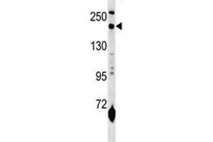 MRC1L1 antibody western blot analysis in mouse lung tissue lysate (Macrophage Mannose Receptor 1 antibody  (AA 359-388))