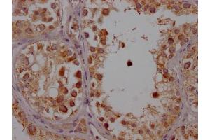 IHC image of ABIN7127446 diluted at 1:100 and staining in paraffin-embedded human testis tissue performed on a Leica BondTM system. (Recombinant CYP17A1 antibody)