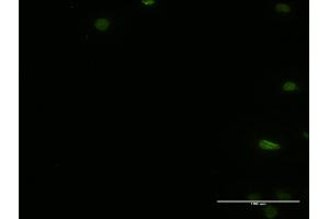Immunofluorescence of monoclonal antibody to PTBP2 on HeLa cell. (PTBP2 antibody  (AA 35-175))