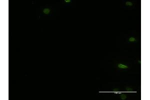 Immunofluorescence of monoclonal antibody to PTBP2 on HeLa cell.