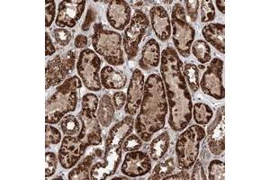 Immunohistochemical staining of human kidney with ZNF445 polyclonal antibody  shows strong granular cytoplasmic positivity in tubular cells.