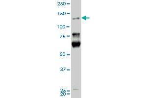 HIPK2 monoclonal antibody (M01), clone 4F4. (HIPK2 antibody  (AA 961-1065))
