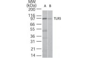 Image no. 1 for anti-Toll-Like Receptor 5 (TLR5) antibody (ABIN208236) (TLR5 antibody)
