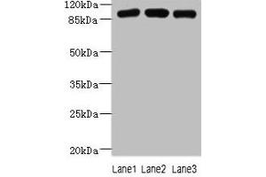 Western blot All lanes: ASAP3 antibody at 1 μg/mL Lane 1: A549 whole cell lysate Lane 2: MCF-7 whole cell lysate Lane 3: K562 whole cell lysate Secondary Goat polyclonal to rabbit IgG at 1/10000 dilution Predicted band size: 100, 44, 98 kDa Observed band size: 100 kDa (ASAP3 antibody  (AA 451-700))