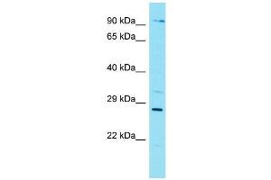Host:  Rabbit  Target Name:  Nkx3-1  Sample Type:  Mouse Lung lysates  Antibody Dilution:  1. (NKX3-1 antibody  (Middle Region))