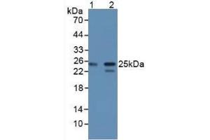Figure. (CBFB antibody  (AA 1-182))