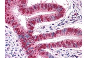 Immunohistochemical analysis of paraffin-embedded human Uterus tissues using MUM1 mouse mAb (MUM1 antibody)