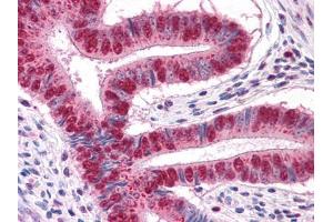 Immunohistochemical analysis of paraffin-embedded human Uterus tissues using MUM1 mouse mAb