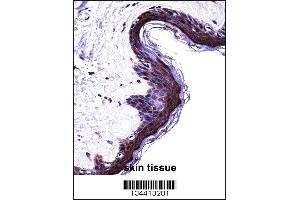 PSMB5 Antibody immunohistochemistry analysis in formalin fixed and paraffin embedded human skin tissue followed by peroxidase conjugation of the secondary antibody and DAB staining. (PSMB5 antibody  (C-Term))