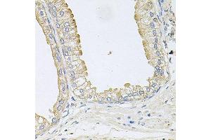 Immunohistochemistry of paraffin-embedded human prostate using ANKH antibody at dilution of 1:100 (x40 lens). (ANKH antibody)