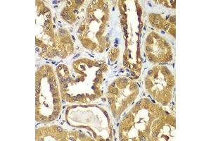 Immunohistochemistry of paraffin-embedded human kidney using RAB1B antibody. (RAB1B antibody  (AA 7-201))