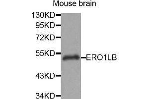 Western Blotting (WB) image for anti-ERO1-Like beta (ERO1LB) antibody (ABIN1875678)