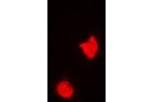 Immunofluorescent analysis of TREX1 staining in A549 cells. (TREX1 antibody)