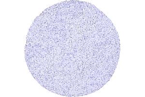 anti-Gastrointestinal Cancer Antigen CA19-9 (CA 19-9) antibody