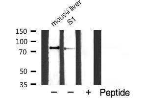 Western blot analysis of TIMP4 expression in NIH-3T3 whole cell lysates,The lane on the left is treated with the antigen-specific peptide. (IKK alpha antibody  (pSer176, pSer177))