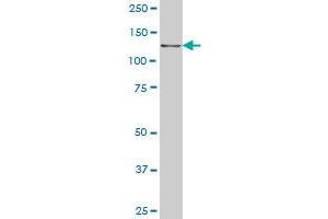 CTNND2 antibody  (AA 1081-1190)