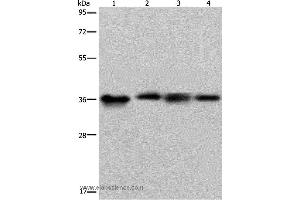 Western blot analysis of HepG2 and 293T cell, human kidney cancer tissue and K562 cell, using F11R Polyclonal Antibody at dilution of 1:500