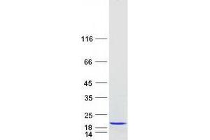Validation with Western Blot (UBE2A Protein (Transcript Variant 1) (Myc-DYKDDDDK Tag))