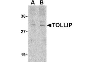 Image no. 1 for anti-Toll Interacting Protein (TOLLIP) (C-Term) antibody (ABIN265153) (TOLLIP antibody  (C-Term))